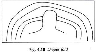 Diaper Fold